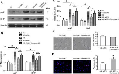 Notoginsenoside R1 Protects Against High Glucose-Induced Cell Injury Through AMPK/Nrf2 and Downstream HO-1 Signaling